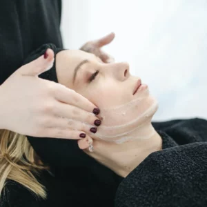 PRP Facial Treatment