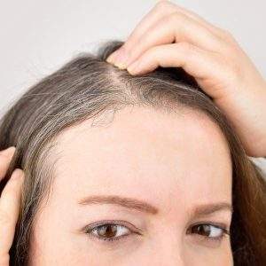 Stress Hair Loss