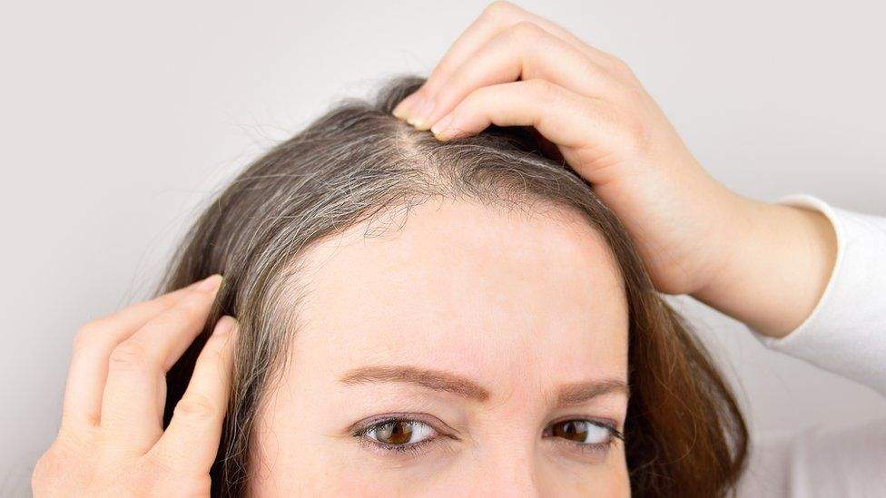 What Causes Stress Hair Loss? – Symptoms And Treatment What Causes Stress Hair Loss? – Symptoms And Treatment