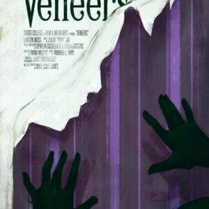 Veneers