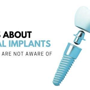 Dental Implants
