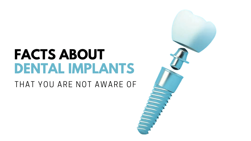 Facts about Dental Implants That You Are Not Aware of